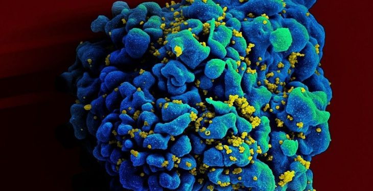 Người thứ 7 trên thế giới được chữa khỏi HIV