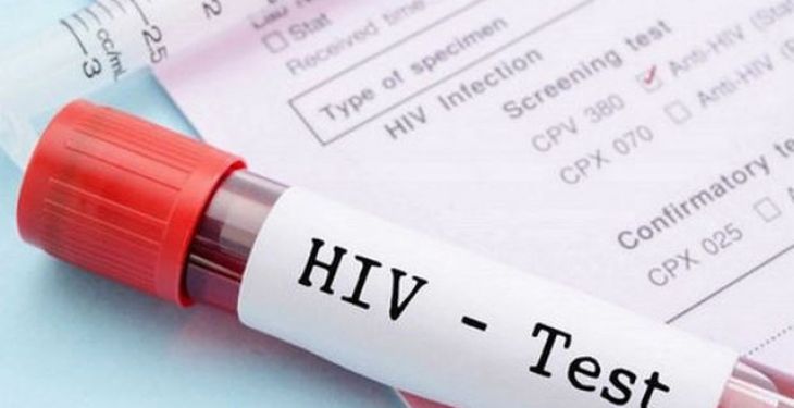 Danh mục nghề phải xét nghiệm HIV trước khi tuyển dụng